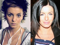 （左）整形前（右）整形後