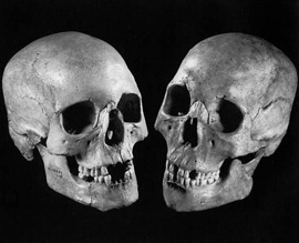 頭蓋骨比較